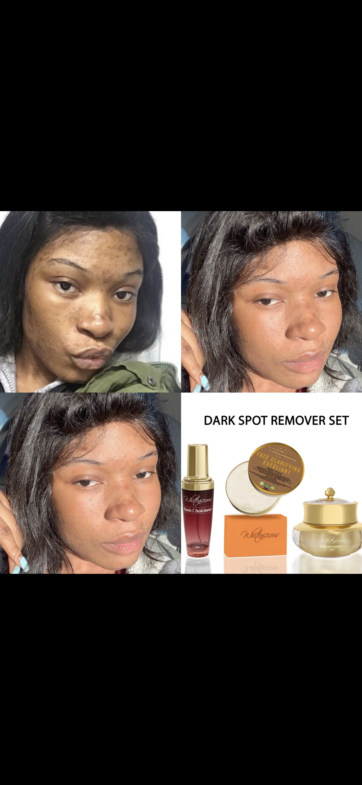 Ude mmiri na-ewepụ ntụpọ gbara ọchịchịrị