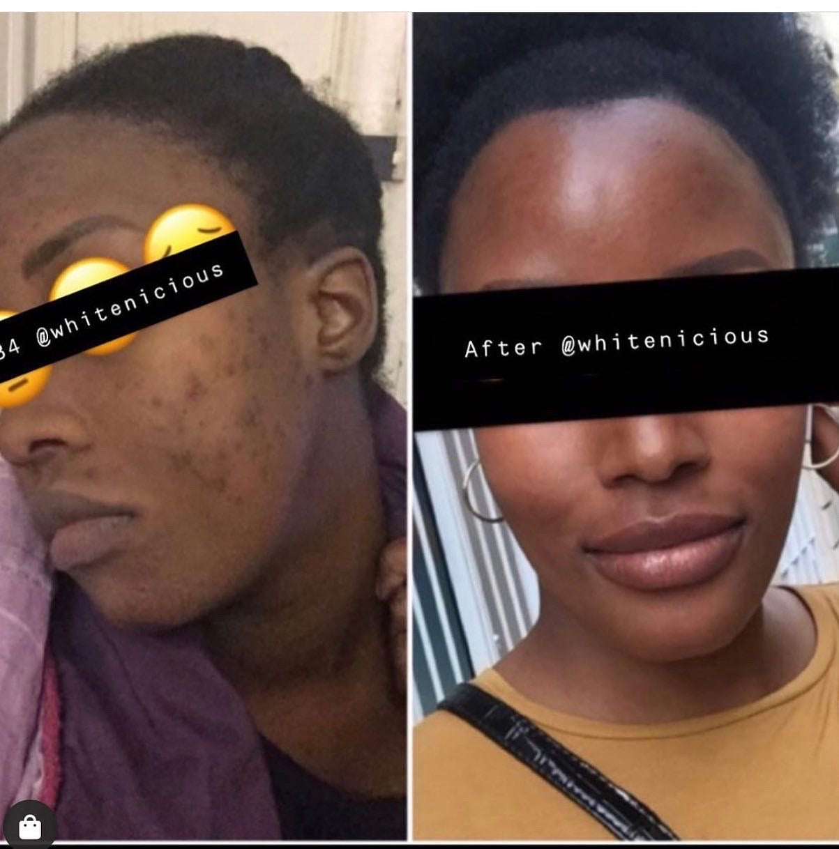Ntọala nchicha ntụpọ gbara ọchịchịrị