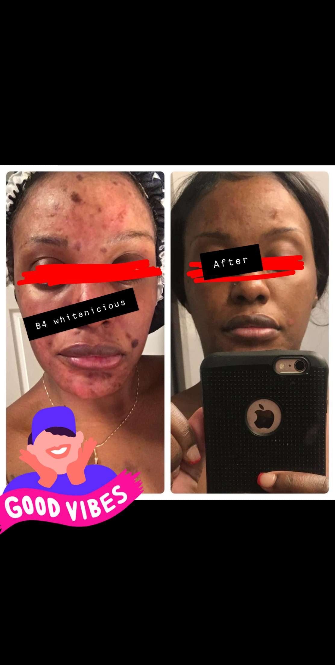 Ude mmiri na-ewepụ ntụpọ gbara ọchịchịrị