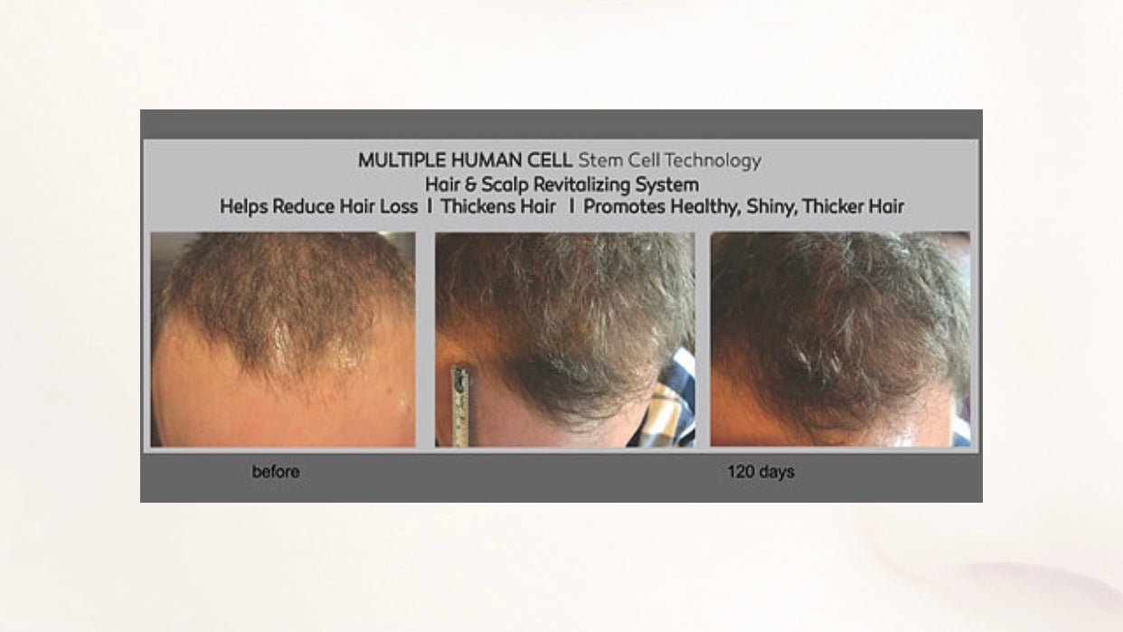 MHCsc™ Nkà na ụzụ MHCsc™ na-eto ntutu na-ewusi ike