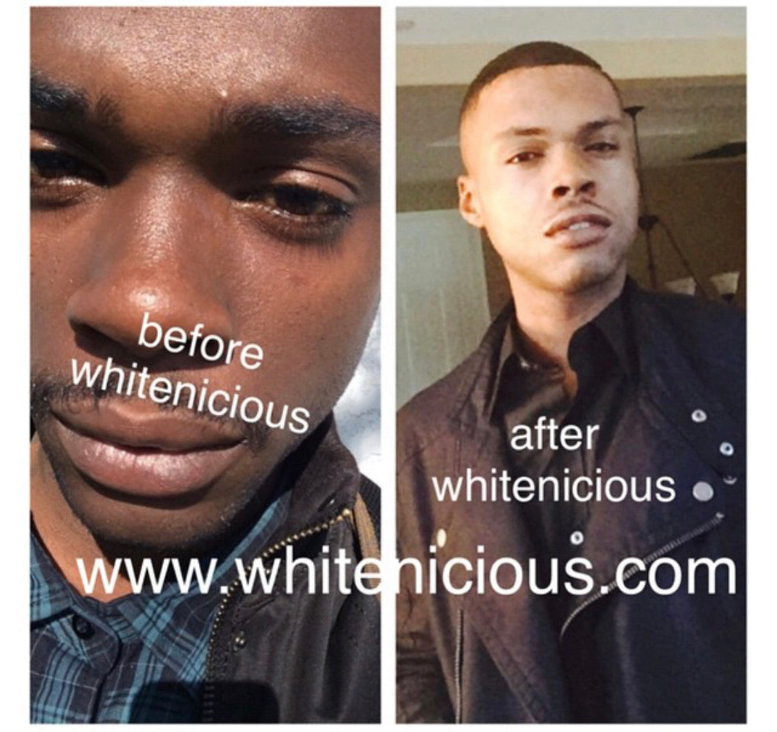 Full Face & Neck Bleaching Cream Blac Chyna 30G | 60G