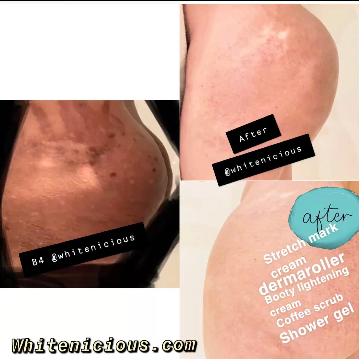 BUTT/ INNER THIGHS LIGHTENING