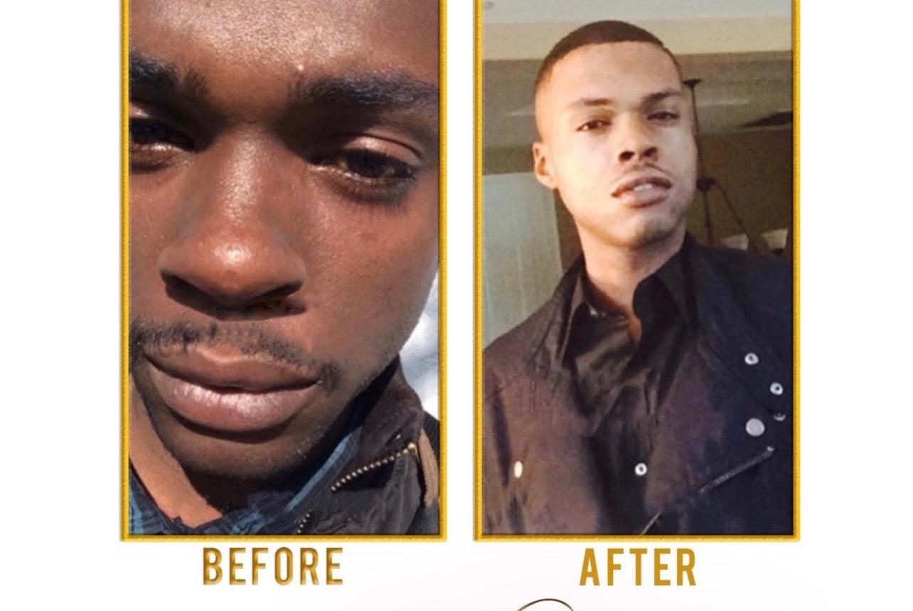 FACE BRIGHTENING/ BLEACHING