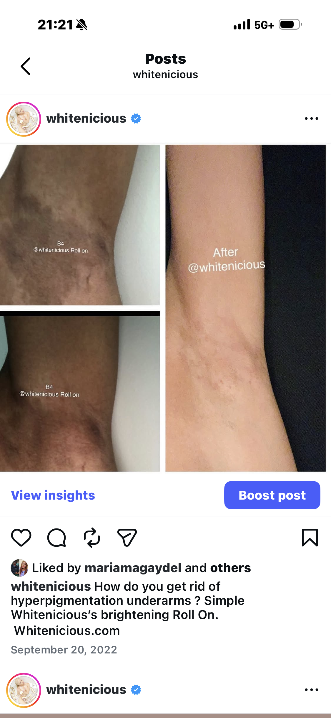 BRIGHTER UNDERARMS