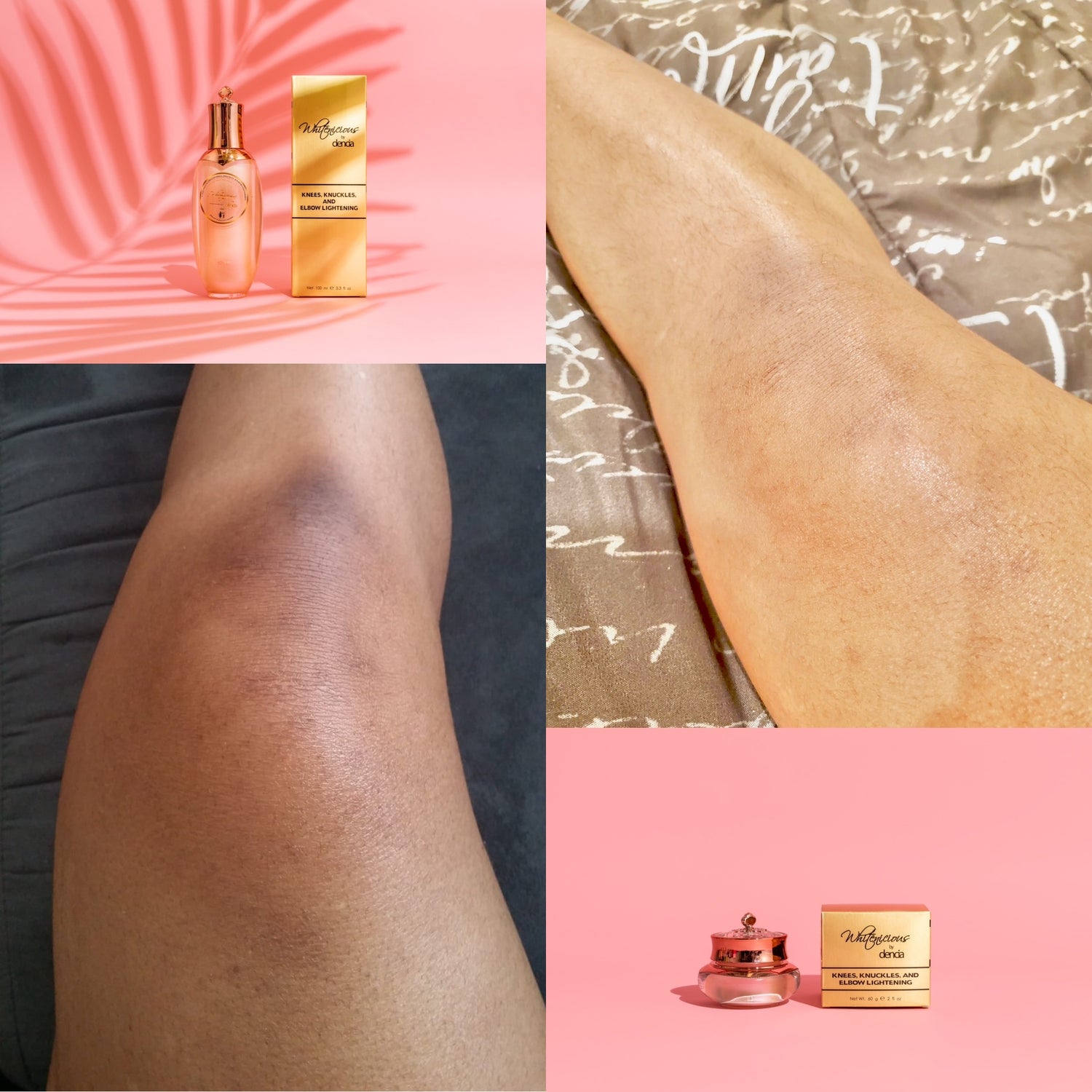 KNUCKLE/ KNEES & ELBOWS PERFECTION