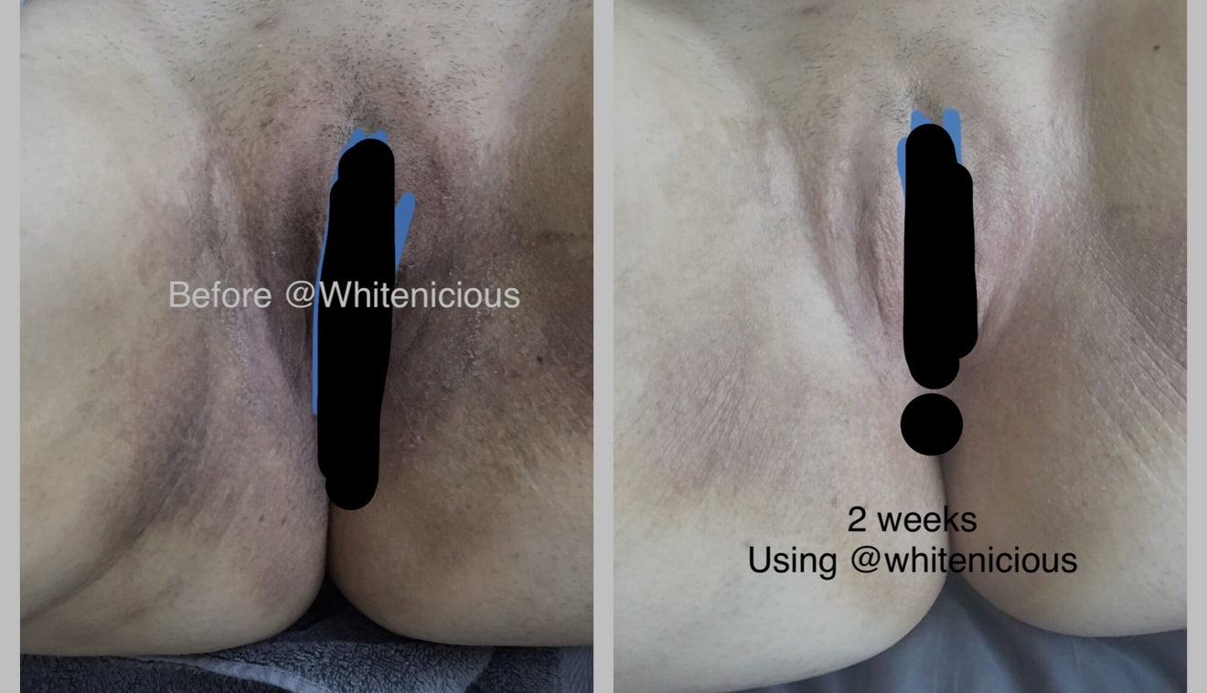 Ude mpaghara chiri anya