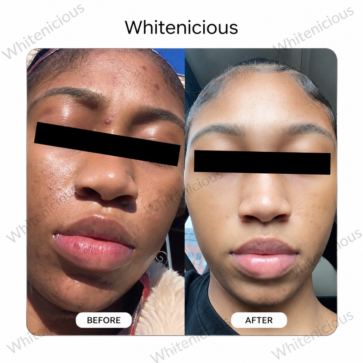 Soft Life Skin Creme