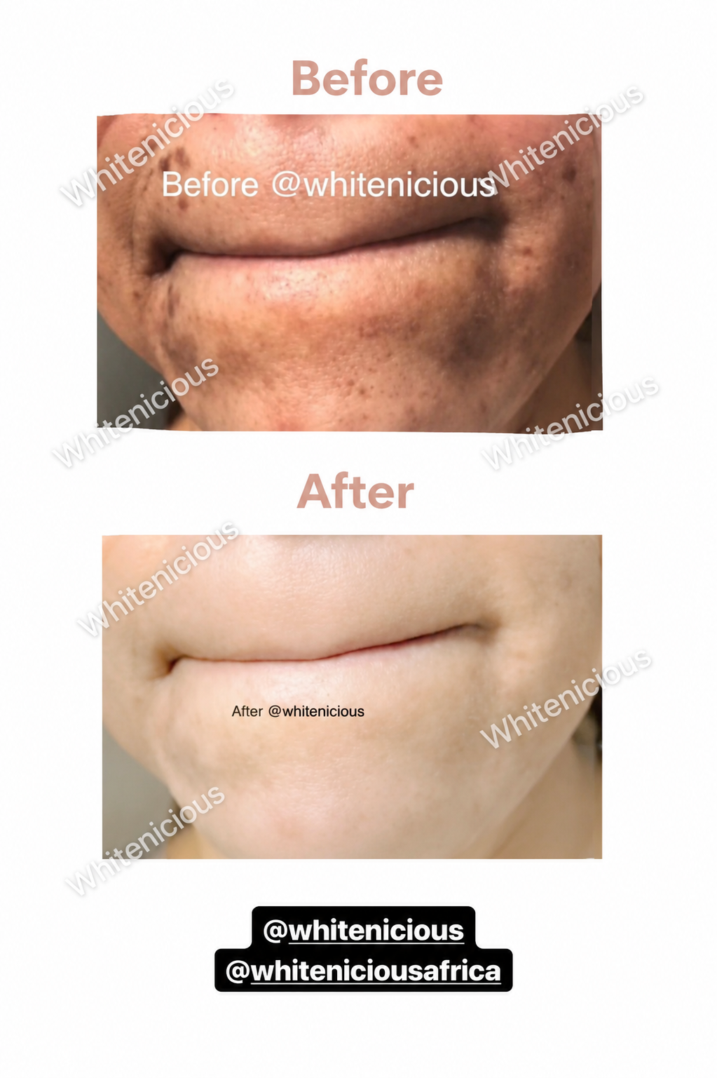 Soft Life Skin Creme