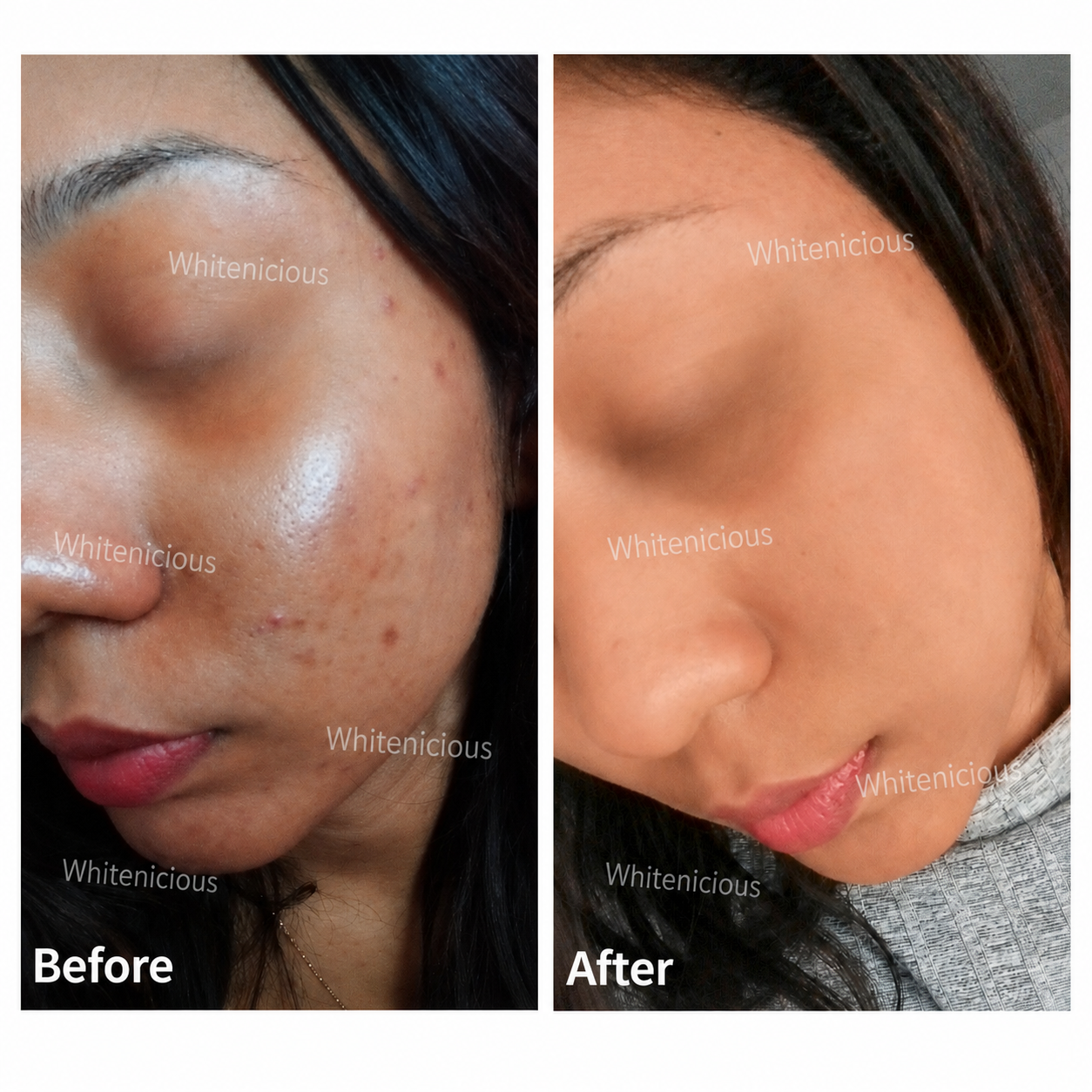 Soft Life Skin Creme
