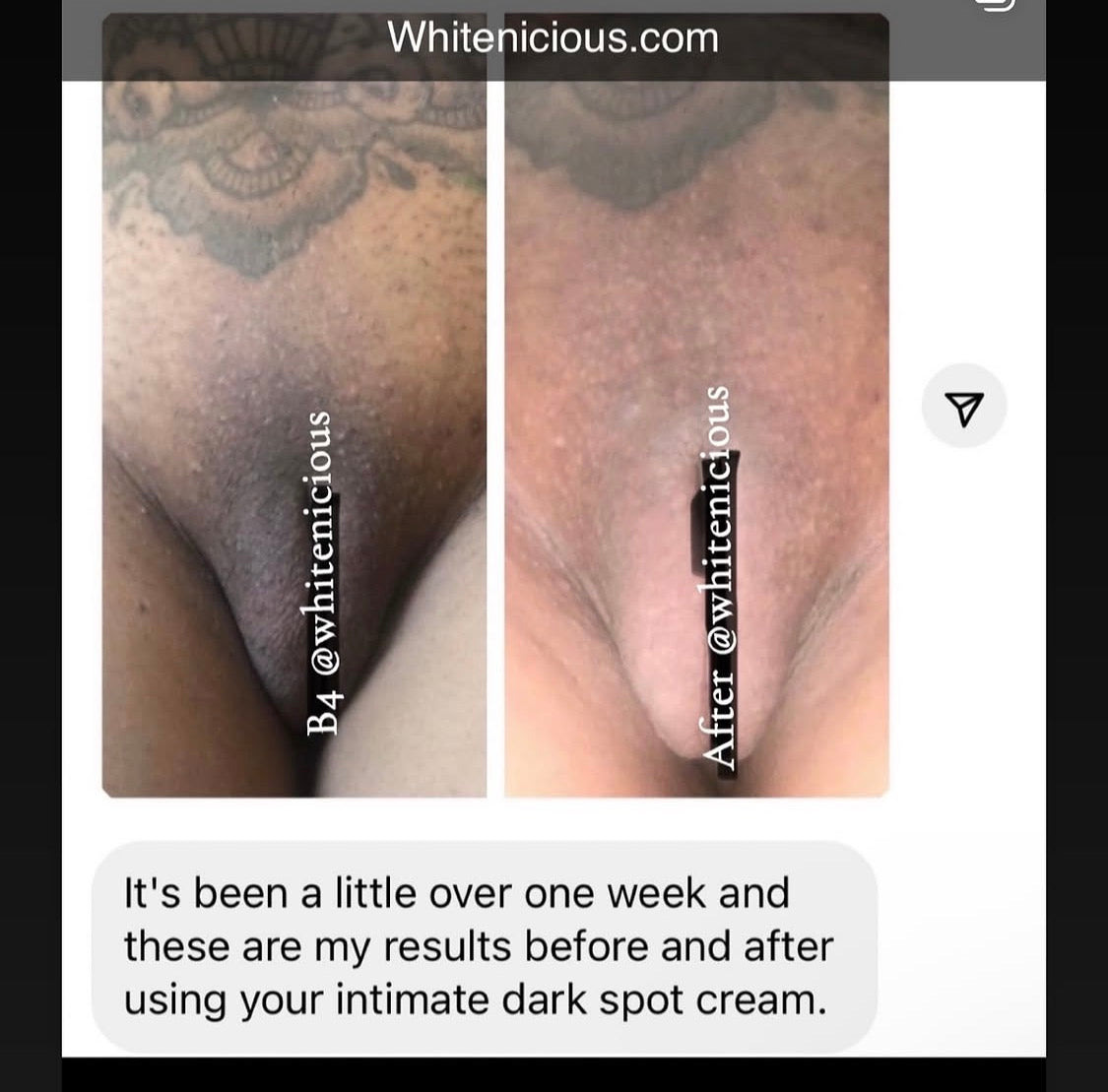 Intimate Areas Brightening Cream