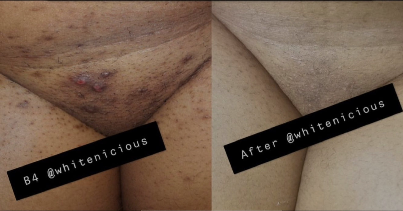 Ude mpaghara chiri anya