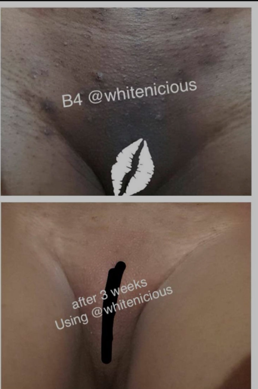 Ude mpaghara chiri anya