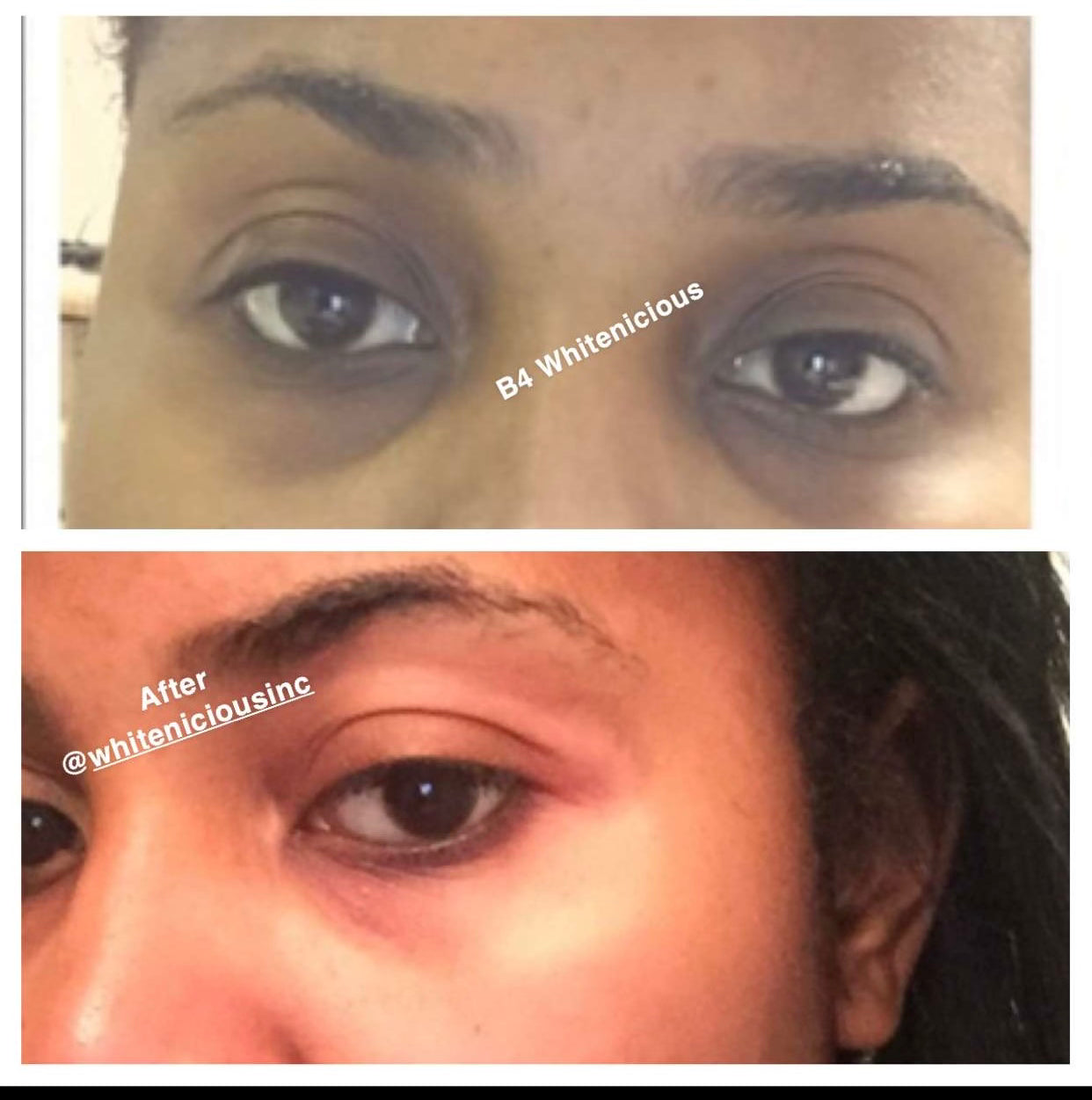 Sun Burn Face Fixer ude